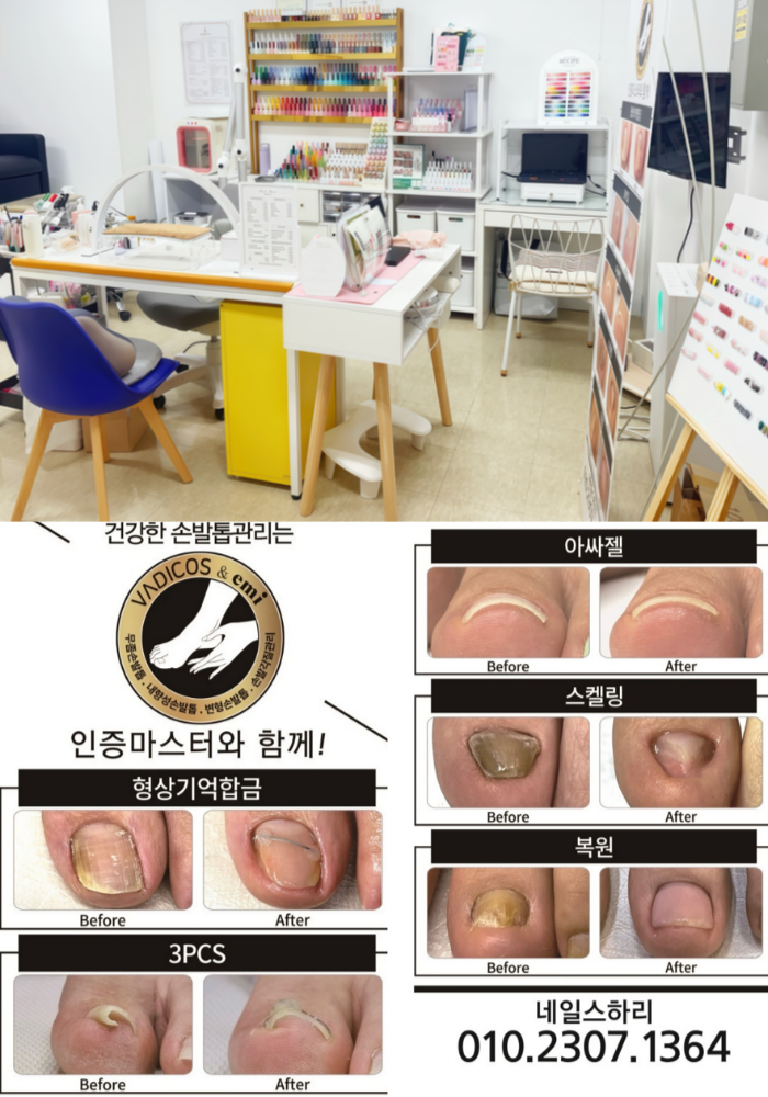 네일스하리 네일스하리